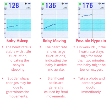 StressFree Fetal Doppler